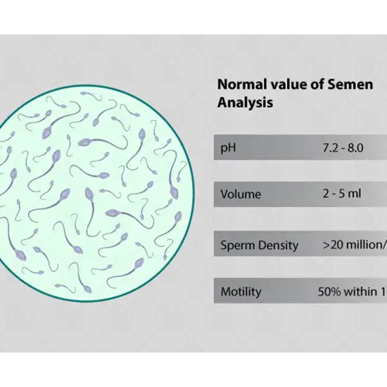 semen analysis test